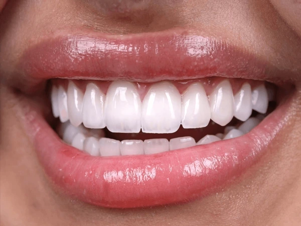What People Are Saying “I’ve been more consistent with my routine and noticed a difference.” – Sam P. “I like how simple it is to include in my day.” – Portia T. “Feels like a good addition to my oral care habits.” – Theo F.